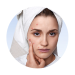 Acne Care