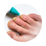 Sulphur & Fungal Care